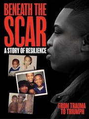 Beneath the Scar: A Story of Resilience