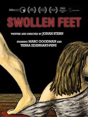 Swollen Feet