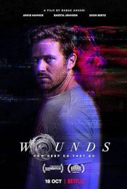 Wounds