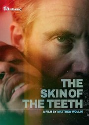 The Skin of the Teeth