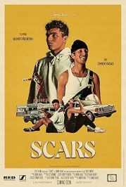 Scars