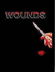 Wounds