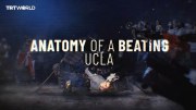 Anatomy of a Beating - The UCLA Palestine Solidarity Encampment